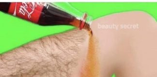 Prestani sa brijanjem! To je najlakši i bezbolan način za uklanjanje dlačica na licu i tijelu!