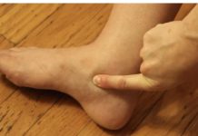 OTEKLE SU VAM NOGE? 3 PUTA DANAS POPIJTE OVAJ NAPITAK I problem riješen