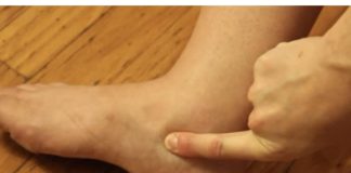 OTEKLE SU VAM NOGE? 3 PUTA DANAS POPIJTE OVAJ NAPITAK I problem riješen