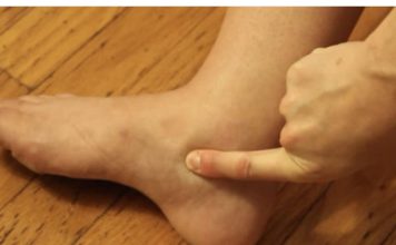 OTEKLE SU VAM NOGE? 3 PUTA DANAS POPIJTE OVAJ NAPITAK I problem riješen