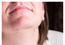 Jeste li se ikada zapitali o pojavi dlaka na bradi kod žena? Istražimo što vaše tijelo možda pokušava komunicirati.