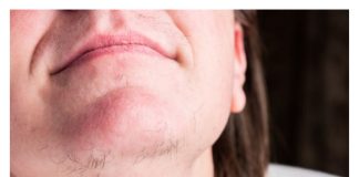 Jeste li se ikada zapitali o pojavi dlaka na bradi kod žena? Istražimo što vaše tijelo možda pokušava komunicirati.