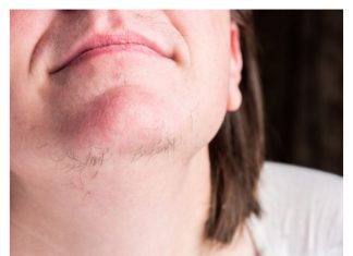 Jeste li se ikada zapitali o pojavi dlaka na bradi kod žena? Istražimo što vaše tijelo možda pokušava komunicirati.