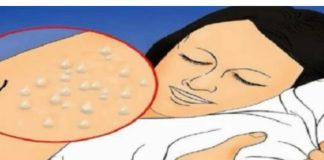 Pretjerano znojenje tijekom noći može ukazivati na prisutnost značajnih bolesti.