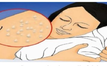 Pretjerano znojenje tijekom noći može ukazivati na prisutnost značajnih bolesti.