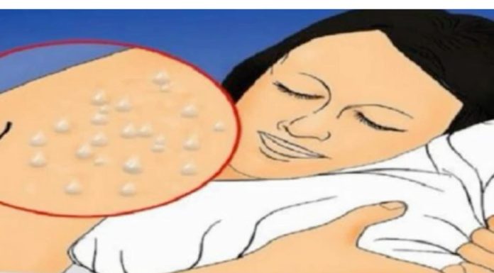 Pretjerano znojenje tijekom noći može ukazivati na prisutnost značajnih bolesti.