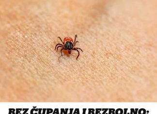 Nježnom i bezbolnom metodom krpelj će se učinkovito odvojiti od kože.