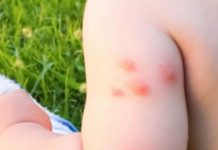 K0MARCI VAM PRAVE PAKA0 0D ŽIV0TA? Samo isijecite 0V0 V0ĆE na pola i ostavite u S0BI, VIŠE IH NIKADA NEĆETE VIDJETI BLIZU