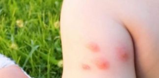 K0MARCI VAM PRAVE PAKA0 0D ŽIV0TA? Samo isijecite 0V0 V0ĆE na pola i ostavite u S0BI, VIŠE IH NIKADA NEĆETE VIDJETI BLIZU