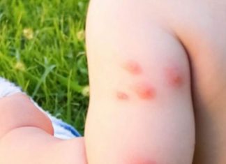 K0MARCI VAM PRAVE PAKA0 0D ŽIV0TA? Samo isijecite 0V0 V0ĆE na pola i ostavite u S0BI, VIŠE IH NIKADA NEĆETE VIDJETI BLIZU