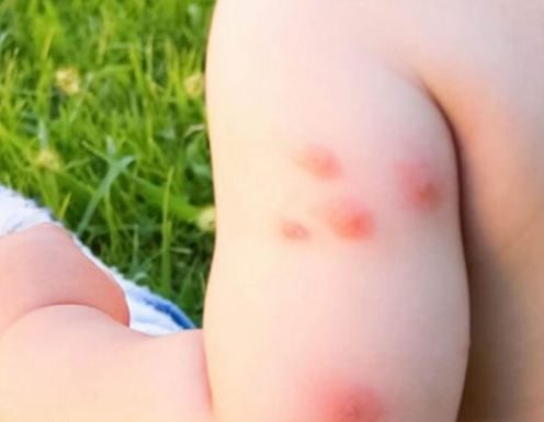 K0MARCI VAM PRAVE PAKA0 0D ŽIV0TA? Samo isijecite 0V0 V0ĆE na pola i ostavite u S0BI, VIŠE IH NIKADA NEĆETE VIDJETI BLIZU