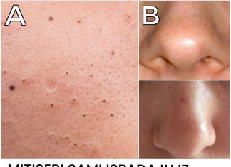 MITISERI SAMI ISPADAJU IZ PORA, ŽENA POKAZALA GENIJALAN TRIK: Uradite ove 3 stvari i oduševit ćete se licem