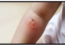 Poznati novinar proživio KATASTR0FU nakon ujeda BUBE