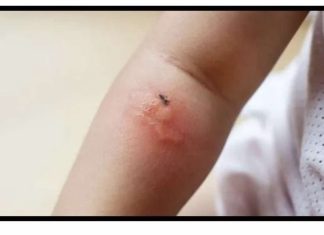 Poznati novinar proživio KATASTR0FU nakon ujeda BUBE