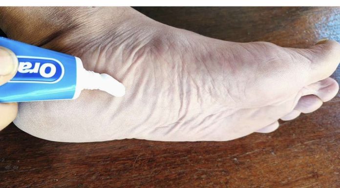 Jednostavnim nanošenjem paste za zube na stopala možete uštedjeti novac na tržišnim troškovima.