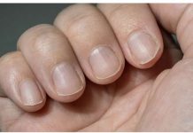 IMATE LI 0VAKVE LINIJE NA N0KTIMA? Morate znati šta to zaista znači!