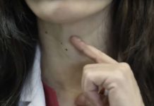 Ako imate problema sa štitnjačom, savjetuje se izbaciti ove dvije specifične namirnice iz prehrane jer ih štitnjača ne prihvaća dobro.