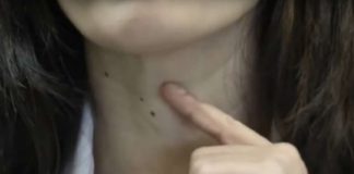 Ako imate problema sa štitnjačom, savjetuje se izbaciti ove dvije specifične namirnice iz prehrane jer ih štitnjača ne prihvaća dobro.