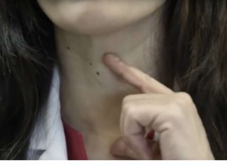 Ako imate problema sa štitnjačom, savjetuje se izbaciti ove dvije specifične namirnice iz prehrane jer ih štitnjača ne prihvaća dobro.