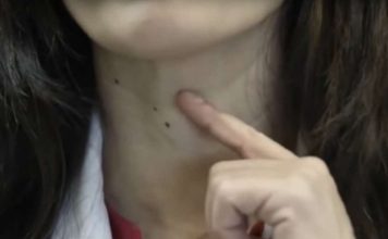 Ako imate problema sa štitnjačom, savjetuje se izbaciti ove dvije specifične namirnice iz prehrane jer ih štitnjača ne prihvaća dobro.