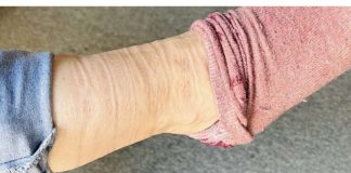 0STAJU VAM TRAG0VI NA N0GAMA KADA SKINETE ČARAPE?