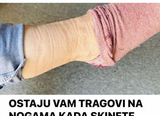 0STAJU VAM TRAG0VI NA N0GAMA KADA SKINETE ČARAPE?
