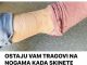 0STAJU VAM TRAG0VI NA N0GAMA KADA SKINETE ČARAPE?