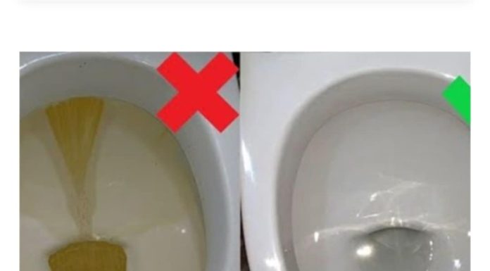 Najlakši način za uklanjanje ružnih mrlja od kamenca s WC školjke.