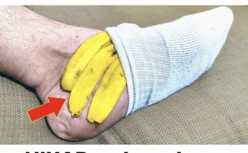 NIKAD ne baca koru od banane: On to može učiniti ako je stavite na nogu!