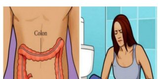 Vodič za prepoznavanje znakova i simptoma raka debelog crijeva.