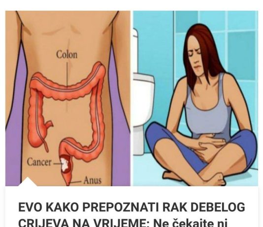Vodič za prepoznavanje znakova i simptoma raka debelog crijeva.