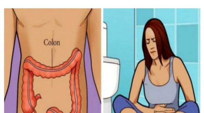 Vodič za prepoznavanje znakova i simptoma raka debelog crijeva.