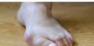 Muče vas BOLNI I RUŽNI ČUKLJEVI? Fizioterapeut nudi RJEŠENJE – nije operacija i košta manje od 2 eura, a ujedno je i PREVENCIJA