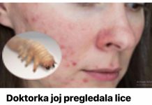 Liječnik je dermoskopom pregledao njezino lice i otkrio da joj KOŽU OŠTEĆUJE PARAZIT – 0prez, stanje koje se vrlo lako širi.
