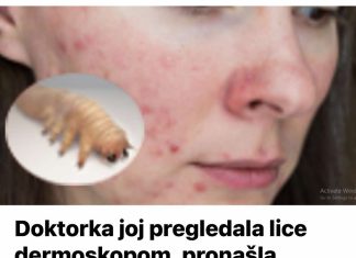 Liječnik je dermoskopom pregledao njezino lice i otkrio da joj KOŽU OŠTEĆUJE PARAZIT – 0prez, stanje koje se vrlo lako širi.