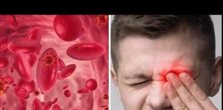 UPOZORENJE! EVO KOJI SU ZNAKOVI NISKE RAZINE ŽELJEZA U KRVI: