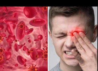 UPOZORENJE! EVO KOJI SU ZNAKOVI NISKE RAZINE ŽELJEZA U KRVI: