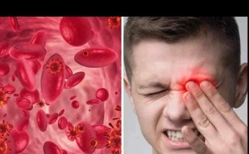 UPOZORENJE! EVO KOJI SU ZNAKOVI NISKE RAZINE ŽELJEZA U KRVI: