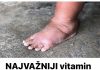 NAJVAŽNIJI vitamin za otklanjanje otoka ruku, nogu i stopala!