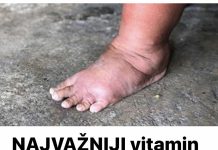 NAJVAŽNIJI vitamin za otklanjanje otoka ruku, nogu i stopala!