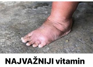 NAJVAŽNIJI vitamin za otklanjanje otoka ruku, nogu i stopala!