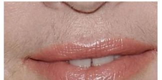 SVAKA ŽENA ZASLUŽUJE DA OVO ZNA: Prirodnim putem uklonite brkove i druge neželjene dlačice sa tijela zauvijek