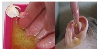 Liječenje upala uha maslinovim uljem.