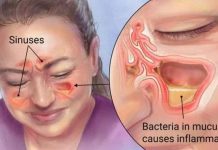 EVO BRZOG NAČINA ZA LIJEČENJE INFEKCIJE SINUSA: Pripremite ovaj domaći napitak i svjedočite ČUDU! (RECEPT)