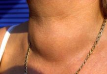 ZA KAFU SMO SVI ZNALI ALI OVO POVRĆE JE JE NAJGORE ZA ŠTITNU ŽLIJEZDU