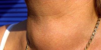 ZA KAFU SMO SVI ZNALI ALI OVO POVRĆE JE JE NAJGORE ZA ŠTITNU ŽLIJEZDU