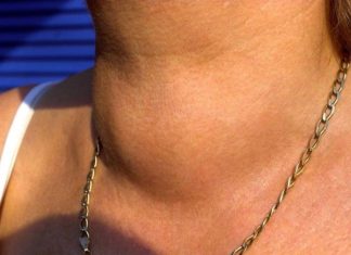 ZA KAFU SMO SVI ZNALI ALI OVO POVRĆE JE JE NAJGORE ZA ŠTITNU ŽLIJEZDU