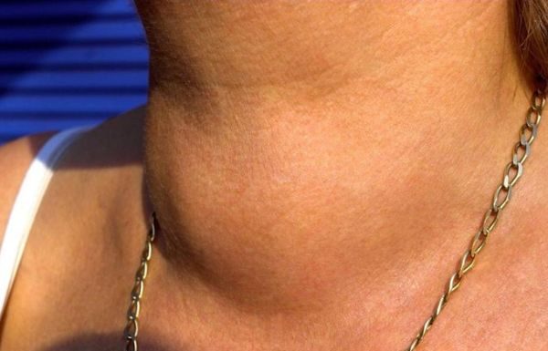 ZA KAFU SMO SVI ZNALI ALI OVO POVRĆE JE JE NAJGORE ZA ŠTITNU ŽLIJEZDU