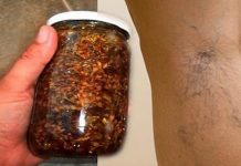 Namažite noge ovim uljem i više nikad nećete imati problema sa proširenim venama (Recept)