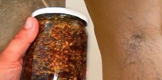 Namažite noge ovim uljem i više nikad nećete imati problema sa proširenim venama (Recept)